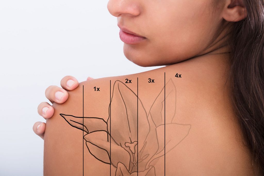 close up of a woman looking over her shoulder, a tattoo on her back showing the various stages of fading after tattoo removal